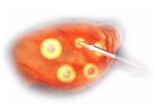 通过孕妇手腕看男女准不准，观察这几个特征就能知道答案