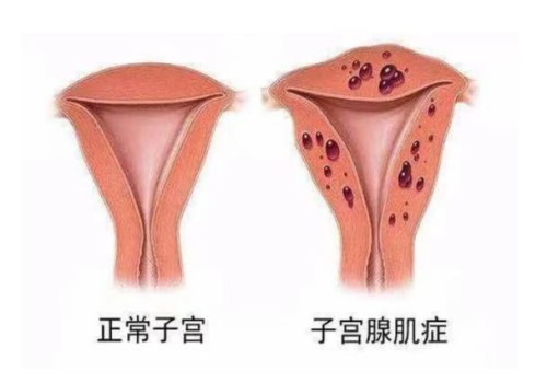 苏州助孕：怀孕建档和不建档的区别不止有能够报销医药费这一件事